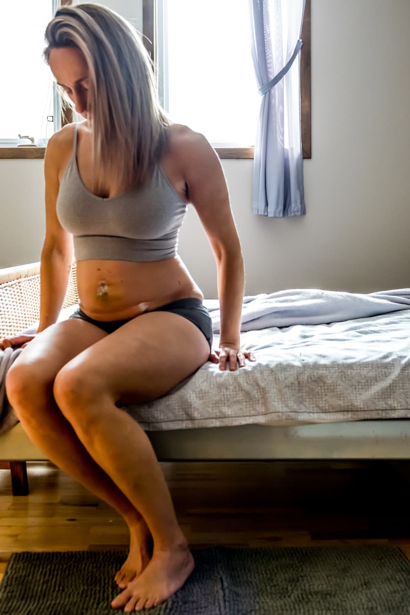 What is a Female Pelvic Laparoscopy?