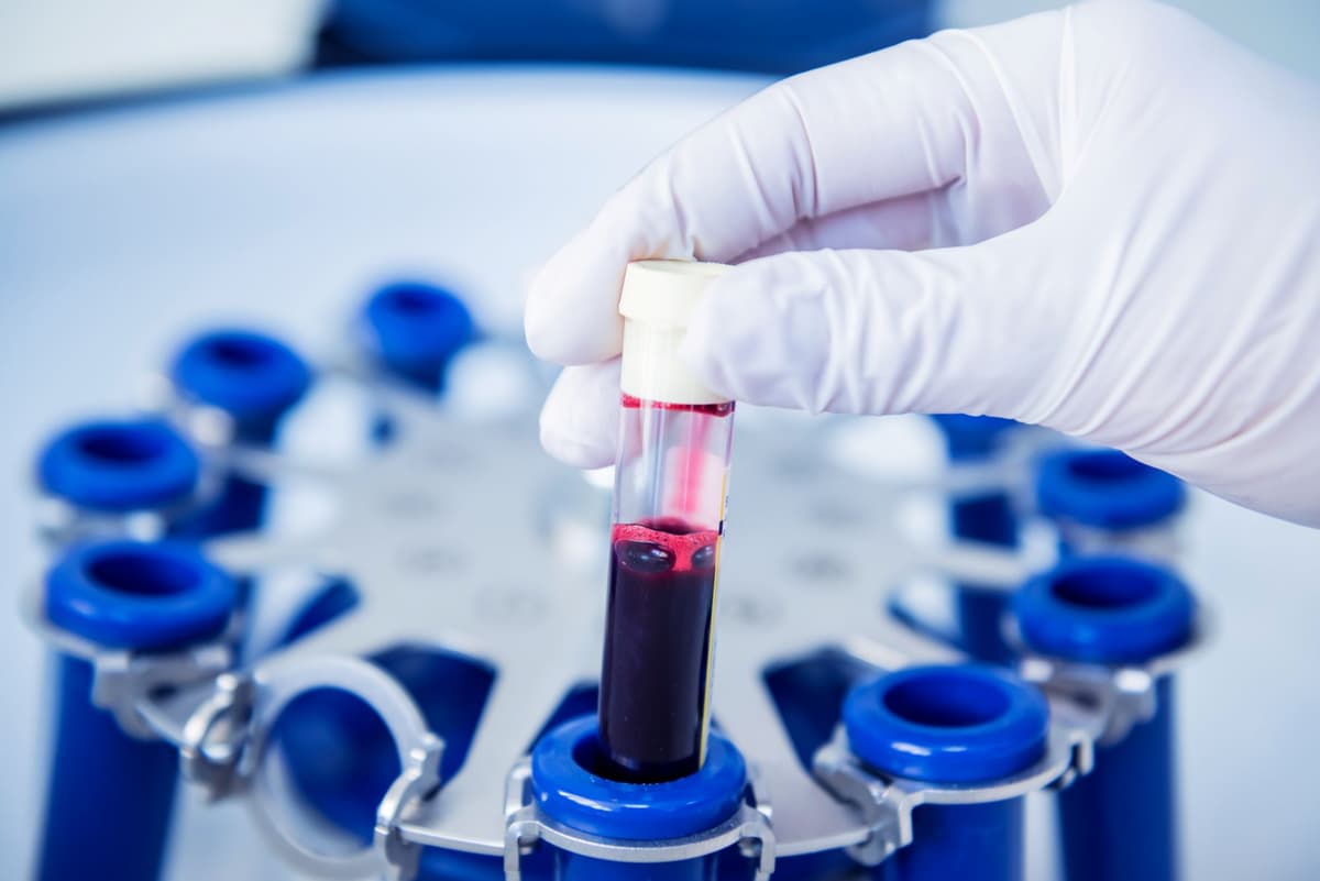 Lab Testing and Cycle Monitoring