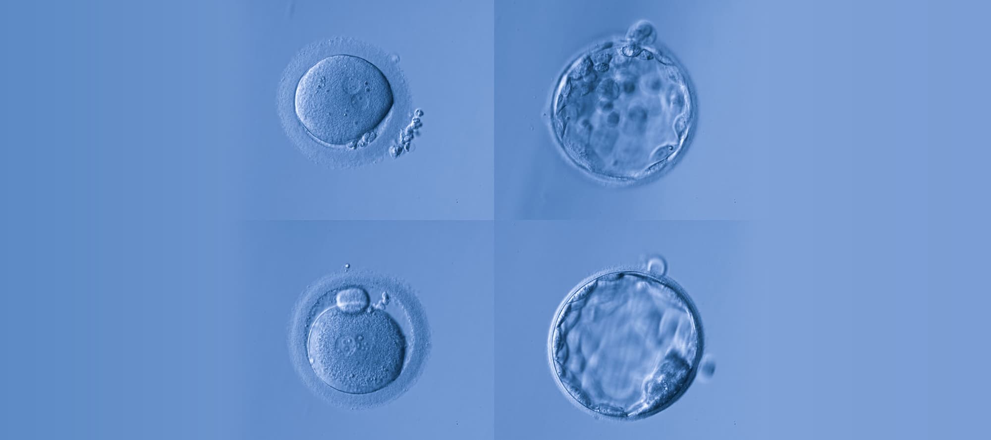 Stages of embryo development from fertilization to blastocyst