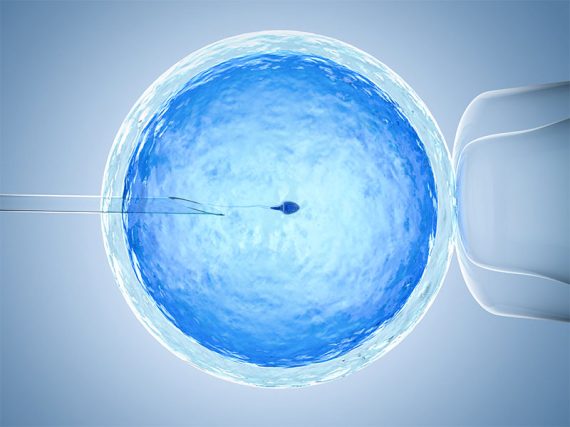 ivf-1